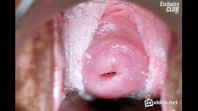 ஒரு அழகான பெண்ணின் மகளிர் மருத்துவ பரிசோதனை